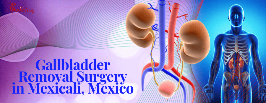 Gallbladder Removal Surgery in Mexicali, Mexico